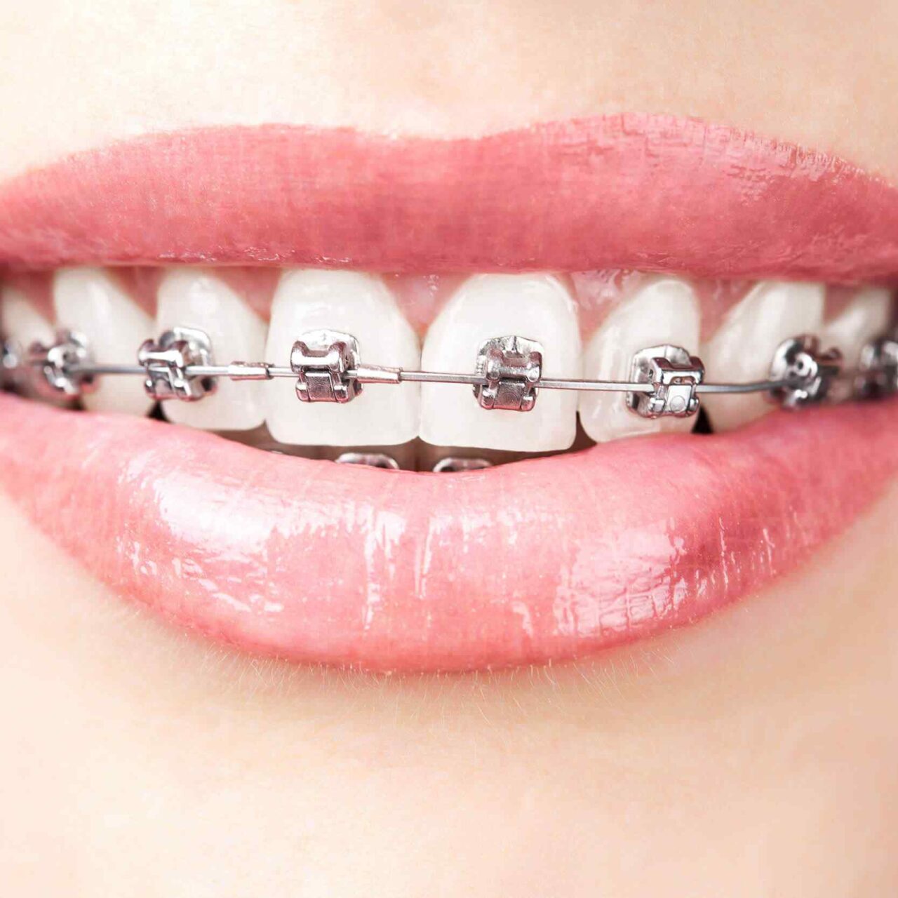 https://www.bhartidental.in/wp-content/uploads/2020/01/post-03-1280x1280.jpg