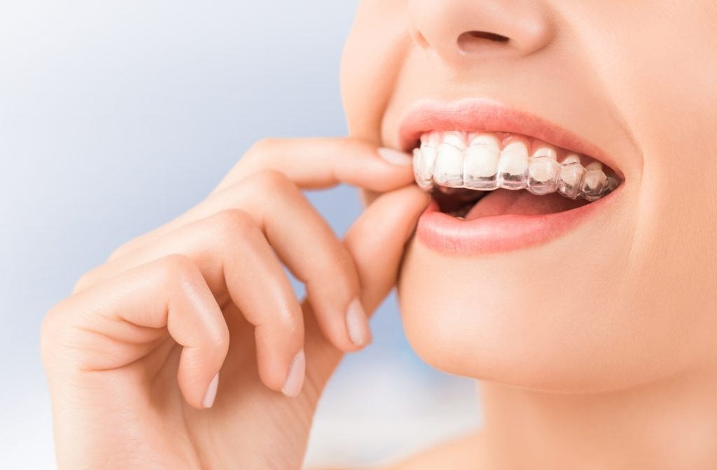 https://www.bhartidental.in/wp-content/uploads/2024/03/WhatsApp-Image-2024-03-06-at-16.33.58_9fe33dd8.jpg